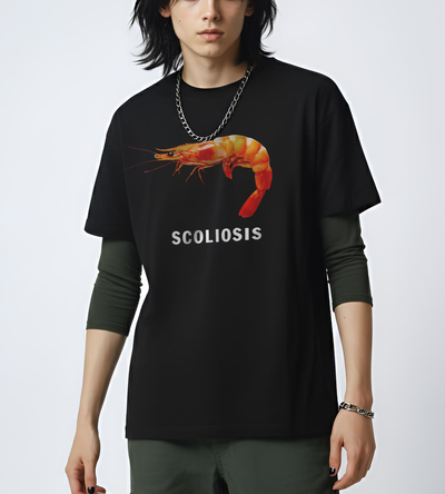 SCOLIOSIS