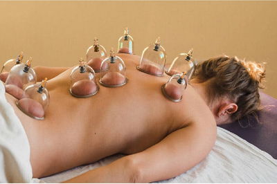 Cupping o Ventosas 