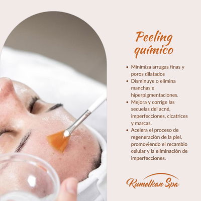 PEELING QUIMICO