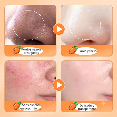 Mascarilla de espuma burbuja zanahoria 4 g c u sodoer (acido salicilico y frutales)