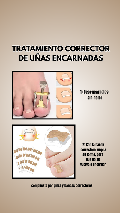Tratamiento corrector para uñas encarnadas