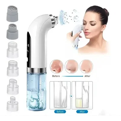 EXTRACTOR FACIAL DE PUNTOS Y ESPINILLAS
