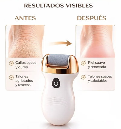 Removedor Exfoliador Quitacallos Eléctrica Usb