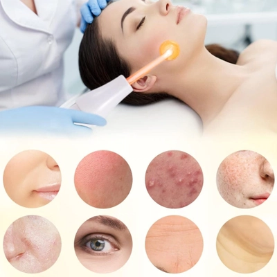 Equipo De Alta Frecuencia Para Piel y Cabello