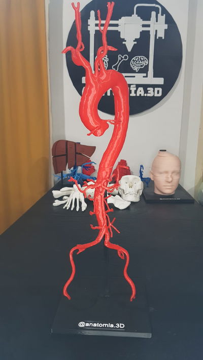 Aorta Humana
