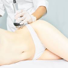 Corporal Radiofrecuencia