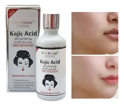 Sérum Facial de Ácido Kójico – Aclarante y Despigmentante