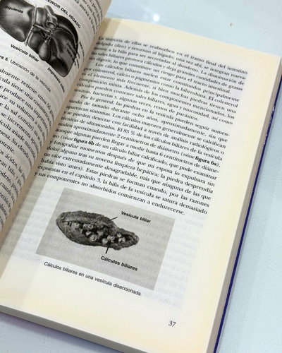 Limpieza hepatica y de la vesicula. Andreas Moritz. Ediciones Obelisco